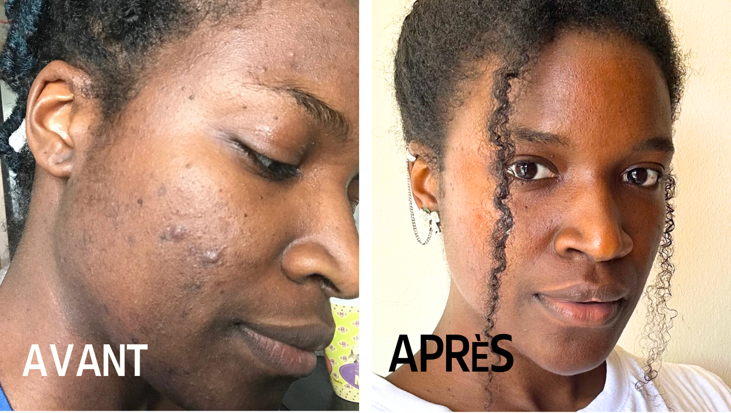 Coaching nutritionnel ponctuel  — 1h30 pour reprendre ta santé en main